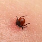 بیماریابی سریع مانع شیوع تب کریمه کنگو در جنوب غرب خوزستان شد