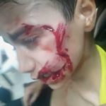 مرگ تلخ کودک ۹ ساله مسجدسلیمانی در سایه بی توجهی مسئولان